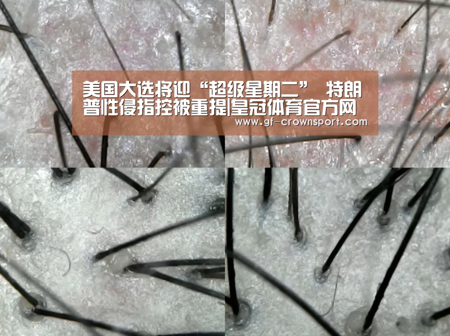 美国大选将迎“超级星期二” 特朗普性侵指控被重提|皇冠体育官方网站(图1) 皇冠体育网址
